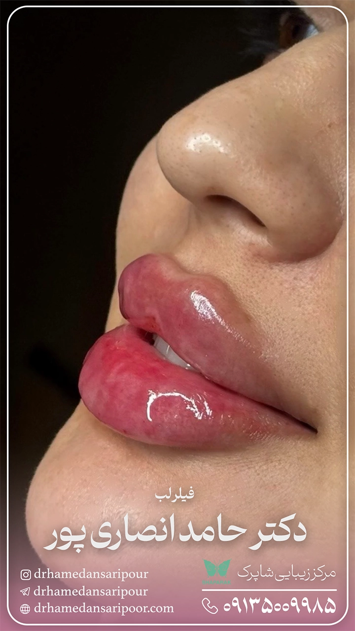 ۳۷